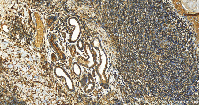 IQGAP1 Antibody in Immunohistochemistry (Paraffin) (IHC (P))