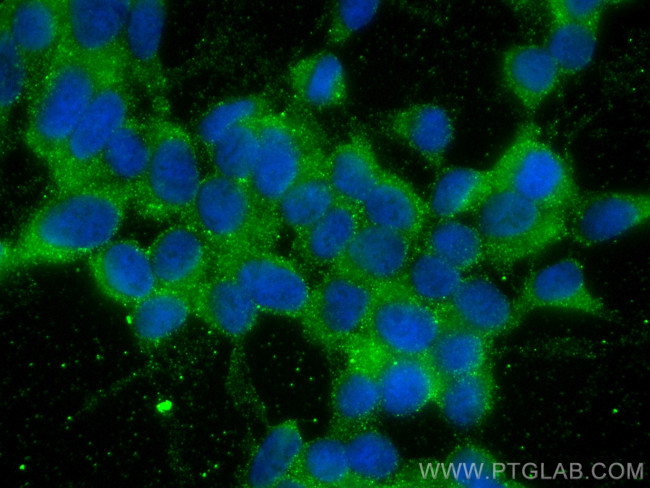HOMER1 Antibody in Immunocytochemistry (ICC/IF)
