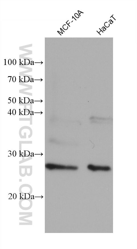 RAB38 Antibody in Western Blot (WB)