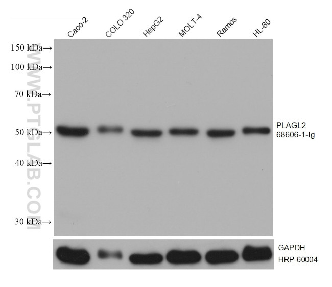 PLAGL2 Antibody in Western Blot (WB)
