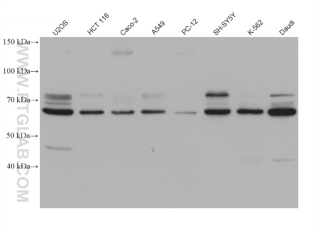 TCF4 Antibody in Western Blot (WB)