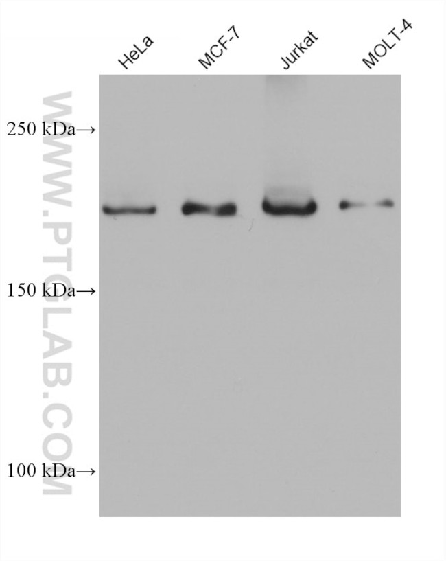BCOR Antibody in Western Blot (WB)