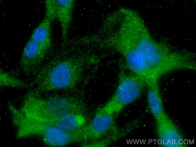 Angiopoietin 1 Antibody in Immunocytochemistry (ICC/IF)