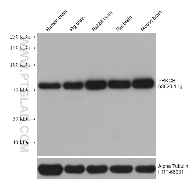PRKCB Antibody in Western Blot (WB)