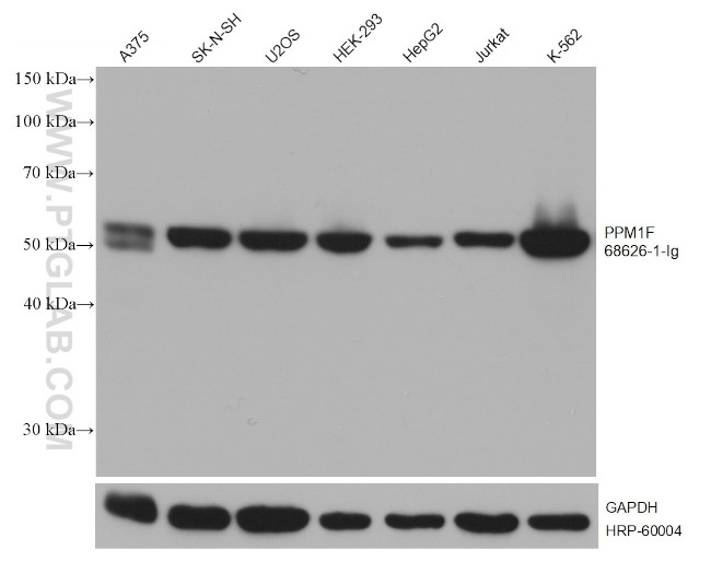 PPM1F Antibody in Western Blot (WB)