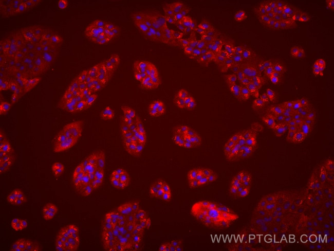 TNNT1 Antibody in Immunocytochemistry (ICC/IF)