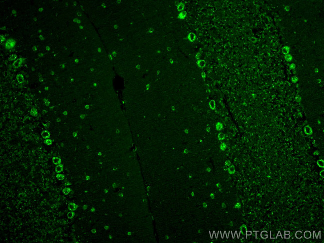 SORLA Antibody in Immunohistochemistry (Paraffin) (IHC (P))