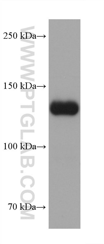 Collagen Type VI Antibody in Western Blot (WB)