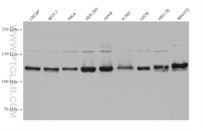 SMC5 Antibody in Western Blot (WB)