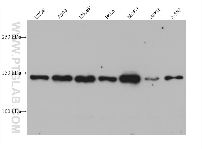 SDCCAG1 Antibody in Western Blot (WB)