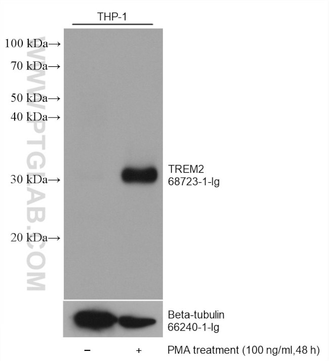 TREM2 Antibody in Western Blot (WB)