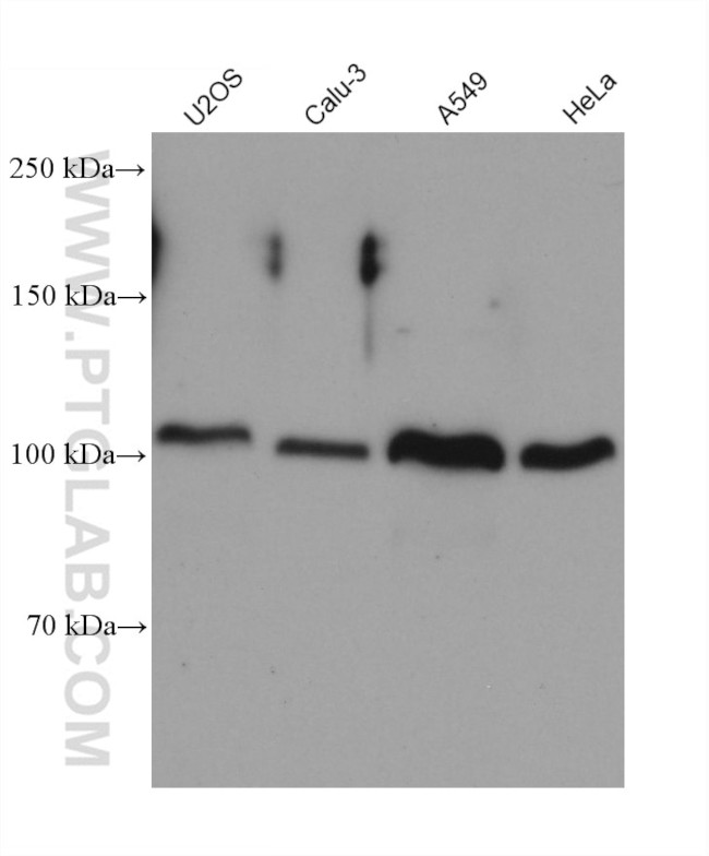 ADAM17 Antibody in Western Blot (WB)