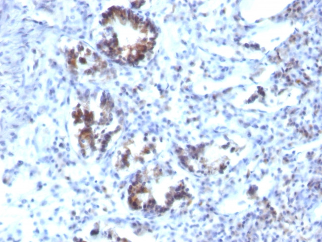 Transgelin (SM22-alpha) Antibody in Immunohistochemistry (Paraffin) (IHC (P))
