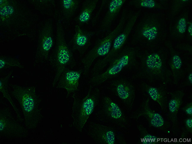 EIF6 Antibody in Immunocytochemistry (ICC/IF)