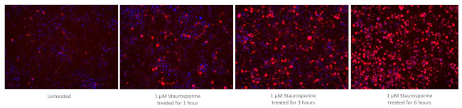 Cleaved Caspase 3 p17 Antibody in Immunocytochemistry (ICC/IF)