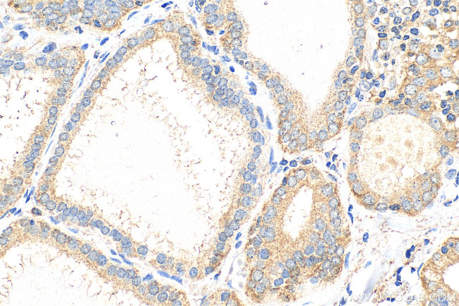 CALCA/CGRP Antibody in Immunohistochemistry (Paraffin) (IHC (P))