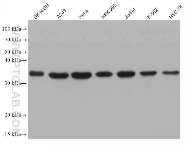 PTGDS Antibody in Western Blot (WB)