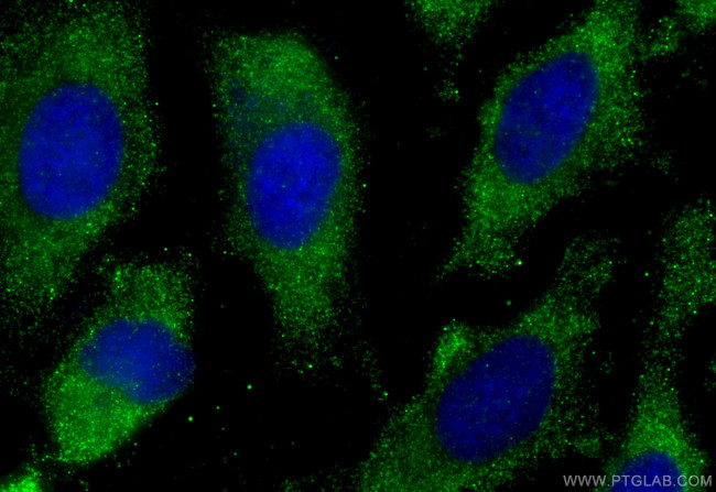 EIF2B1 Antibody in Immunocytochemistry (ICC/IF)