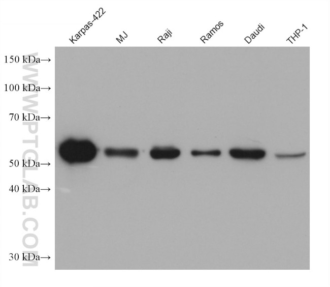 ZC3H12D Antibody in Western Blot (WB)