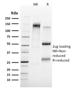 Tal1 Antibody in SDS-PAGE (SDS-PAGE)