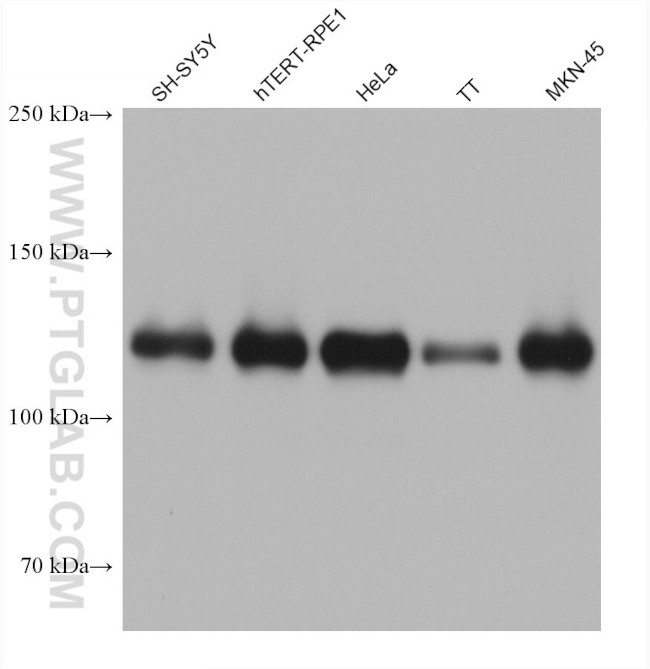 SPHK2 Antibody in Western Blot (WB)