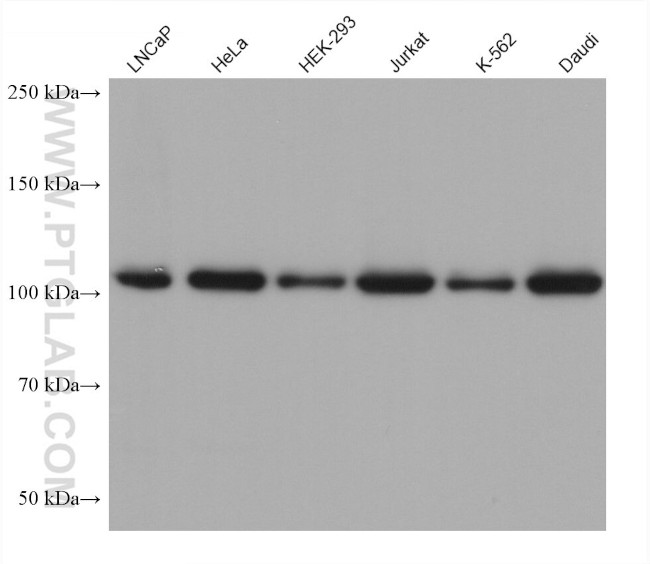 NOP2 Antibody in Western Blot (WB)