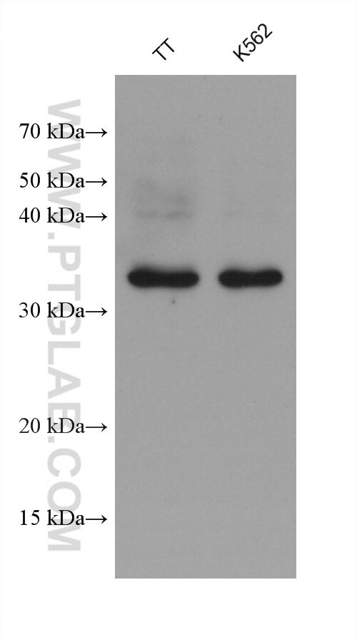 MLXIP Antibody in Western Blot (WB)