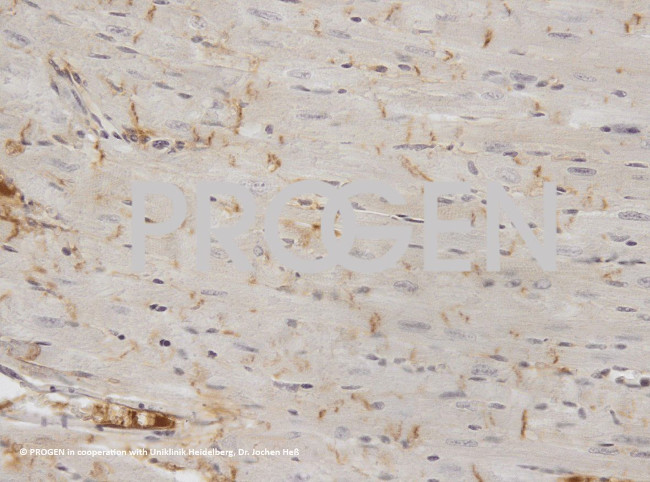 Desmoplakin 1/2 Antibody in Immunohistochemistry (Paraffin) (IHC (P))