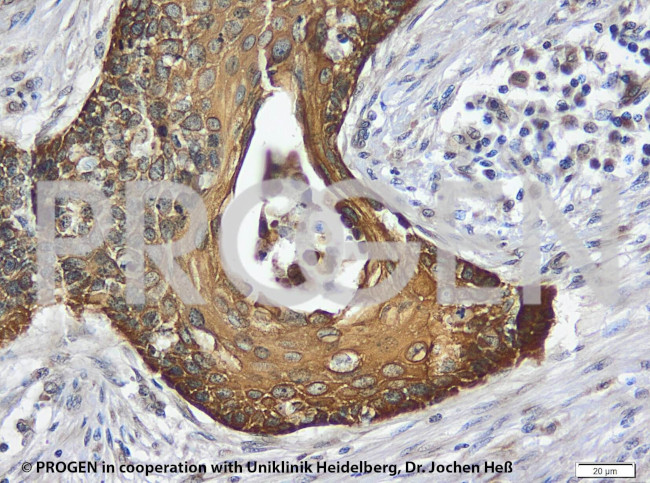 Keratin Type II Antibody in Immunohistochemistry (Paraffin) (IHC (P))