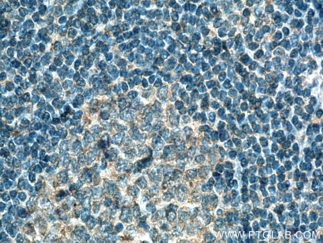 IL-6 Antibody in Immunohistochemistry (Paraffin) (IHC (P))