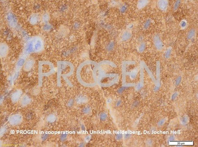 Synaptophysin Antibody in Immunohistochemistry (IHC)
