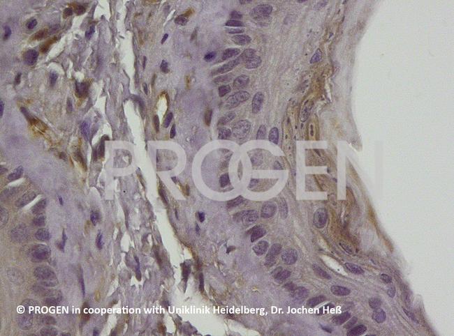 Vimentin Antibody in Immunohistochemistry (IHC)
