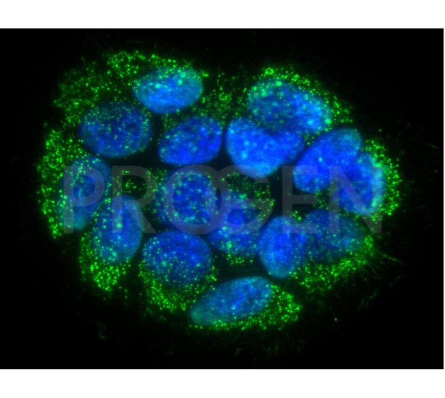 DNA Antibody in Immunocytochemistry (ICC/IF)