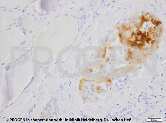Cytokeratin 7 Antibody in Immunohistochemistry (IHC)
