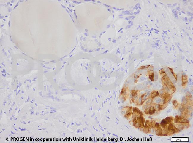 Cytokeratin 7 Antibody in Immunohistochemistry (IHC)
