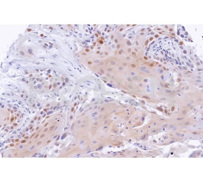 Cyclin D1 Antibody in Immunohistochemistry (Paraffin) (IHC (P))