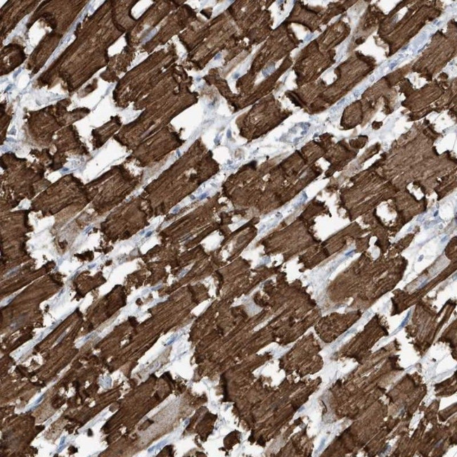 Cardiac Actin Antibody in Immunohistochemistry (IHC)