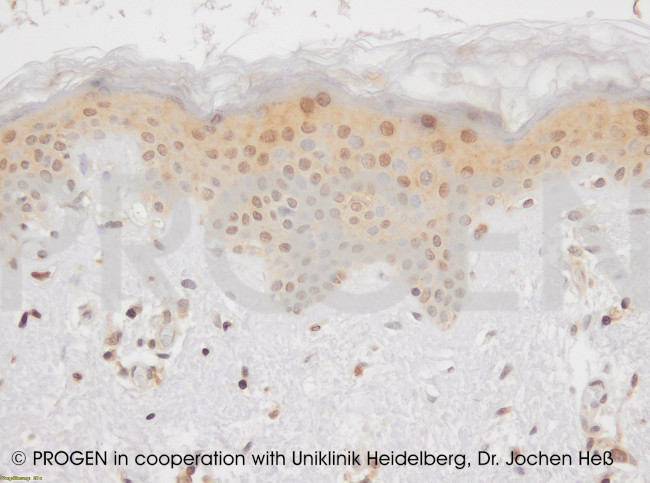 Desmocollin 1 Antibody in Immunohistochemistry (Paraffin) (IHC (P))