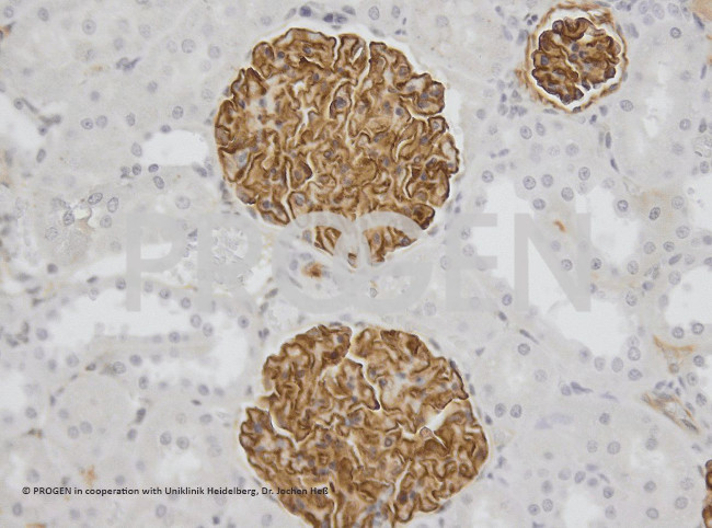Synaptopodin/SYNPO Antibody in Immunohistochemistry (Paraffin) (IHC (P))