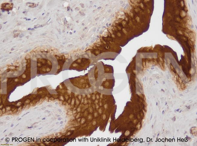 Uroplakin III Antibody in Immunohistochemistry (IHC)