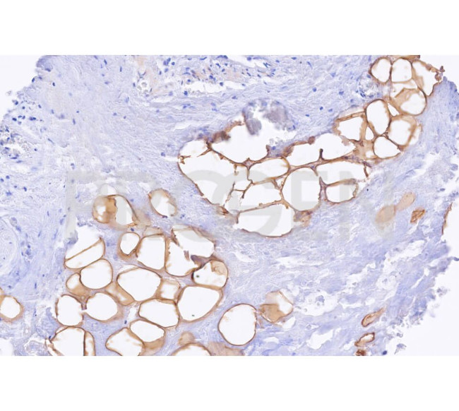 Perilipin 1 Antibody in Immunohistochemistry (Paraffin) (IHC (P))