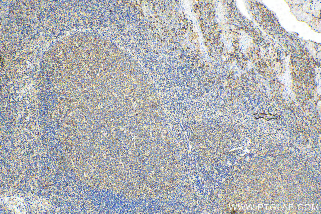 IL-10 Antibody in Immunohistochemistry (Paraffin) (IHC (P))