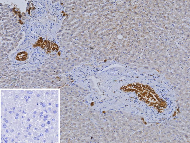 Hepatocyte nuclear factor 1 beta (HNF1b)/Transcription Factor 2 (TCF2) Antibody in Immunohistochemistry (Paraffin) (IHC (P))