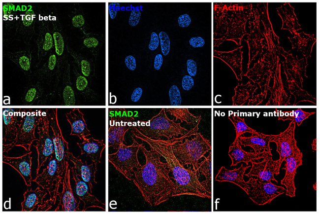 SMAD2 Antibody in Immunocytochemistry (ICC/IF)