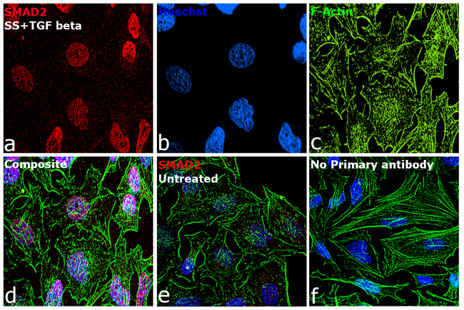 SMAD2 Antibody in Immunocytochemistry (ICC/IF)