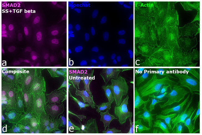 SMAD2 Antibody in Immunocytochemistry (ICC/IF)