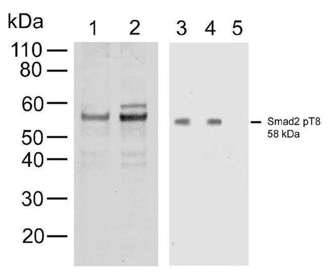 Phospho-SMAD2 (Thr8) Antibody in Western Blot (WB)