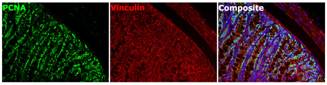 Vinculin Antibody in Immunohistochemistry (Paraffin) (IHC (P))