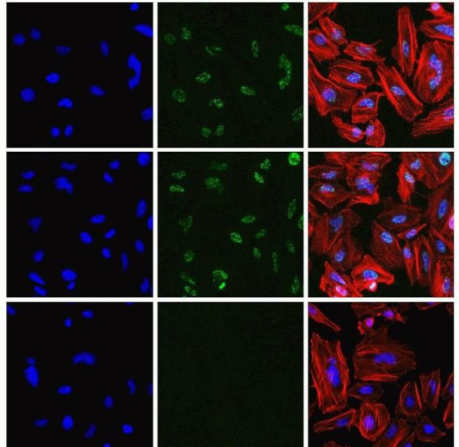 Phospho-AMPK beta-1 (Ser182) Antibody in Immunocytochemistry (ICC/IF)