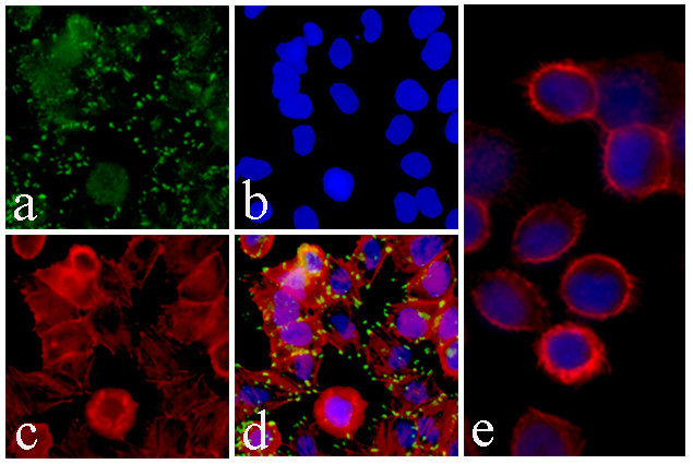 c-Met Antibody in Immunocytochemistry (ICC/IF)